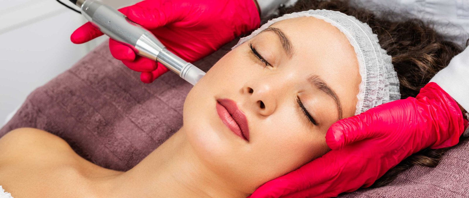Micro-Needling
