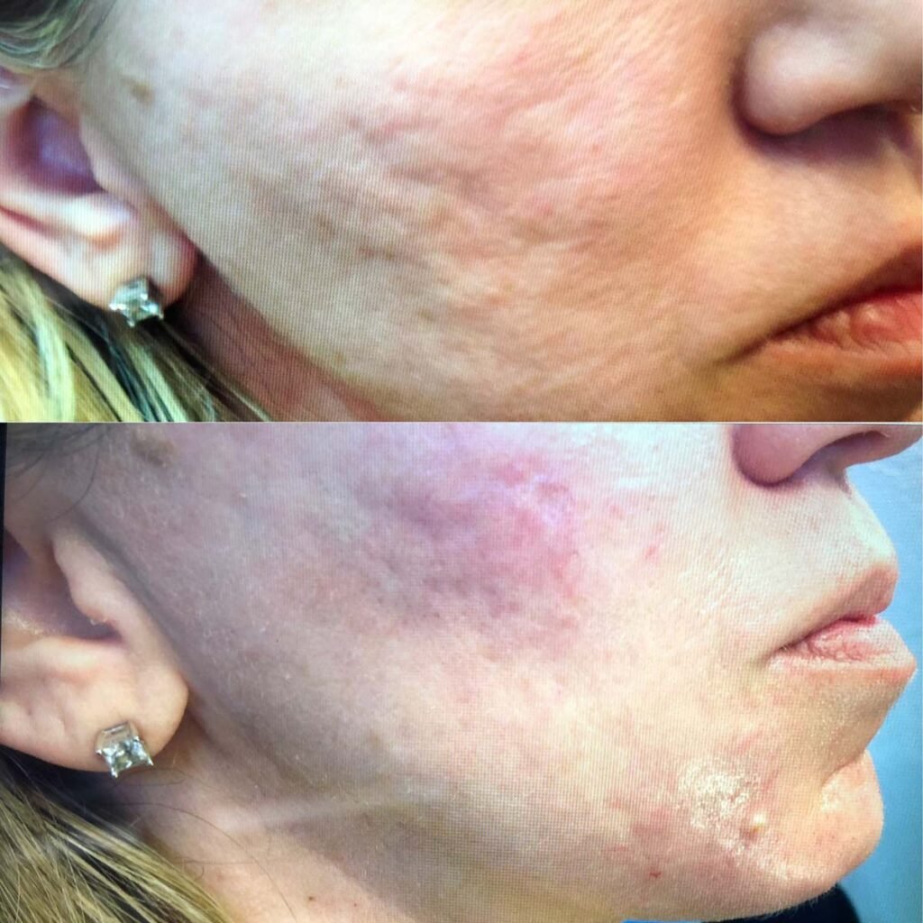 Phoenix Med Spa: Transform & Renew at Phoenix Medspa | Med Spa Phoenix | Medical Spa